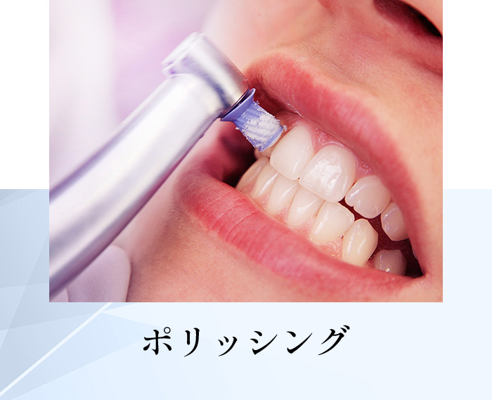 ポリッシング