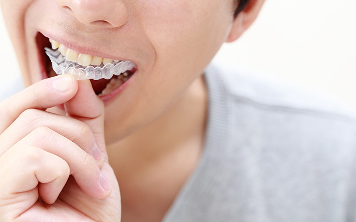 ご自宅でホワイトニング開始 