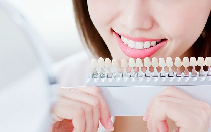 施術後の歯の色のチェック