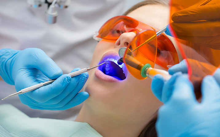 ホワイトニング開始