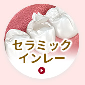 セラミックインレー
