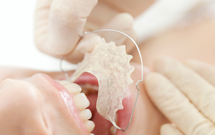 治療終了・保定