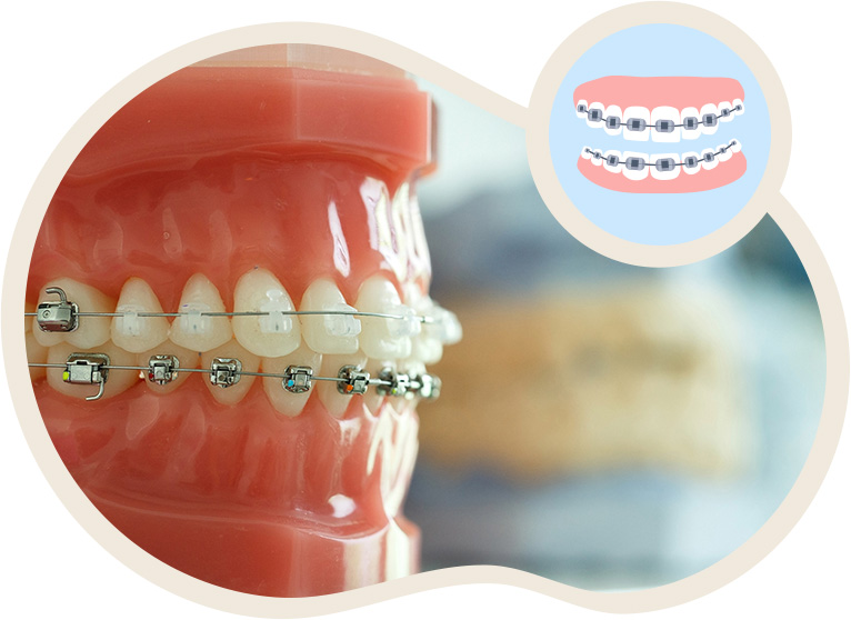 矯正治療をお考えの方へ