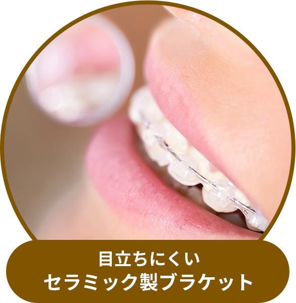 目立ちにくいセラミック製ブラケット