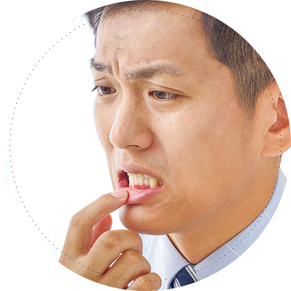 歯ぐきが下がる