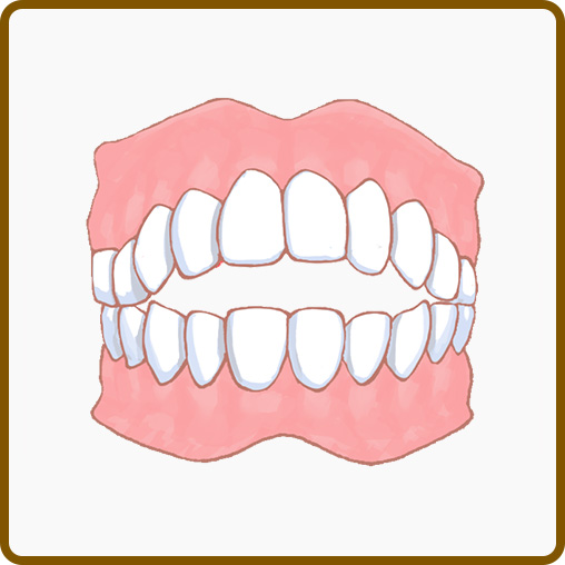 開咬、オープンバイト