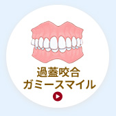 過蓋咬合