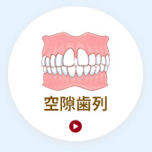 空隙歯列