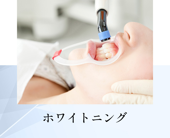 ホワイトニング