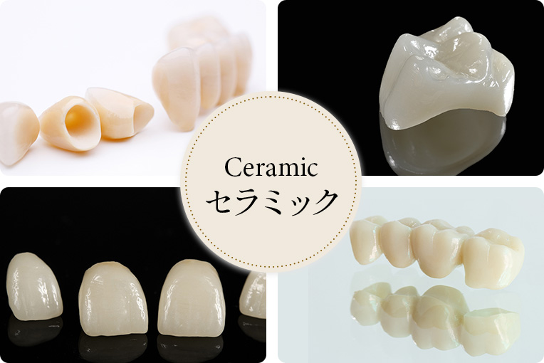 セラミック治療とは