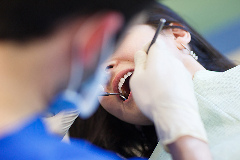 歯を再度削ることになる恐れ