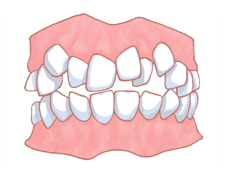 矯正歯科や歯列矯正の専門医院なら渋谷・横浜のスマイルコンセプト