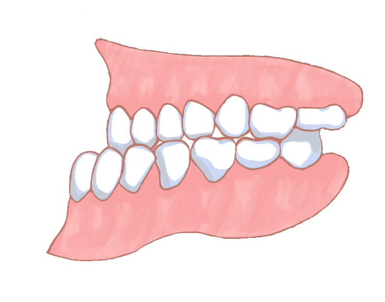 矯正歯科や歯列矯正の専門医院なら渋谷・横浜のスマイルコンセプト