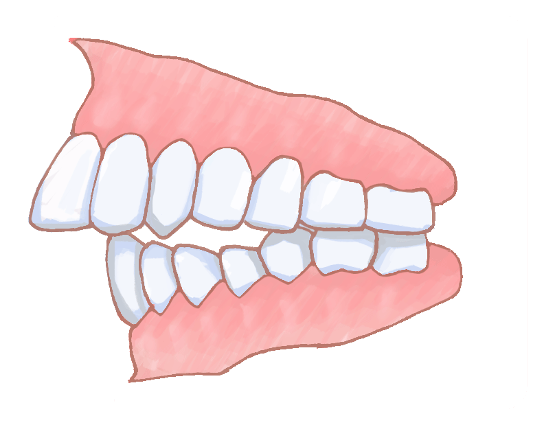 矯正歯科や歯列矯正の専門医院なら渋谷・横浜のスマイルコンセプト