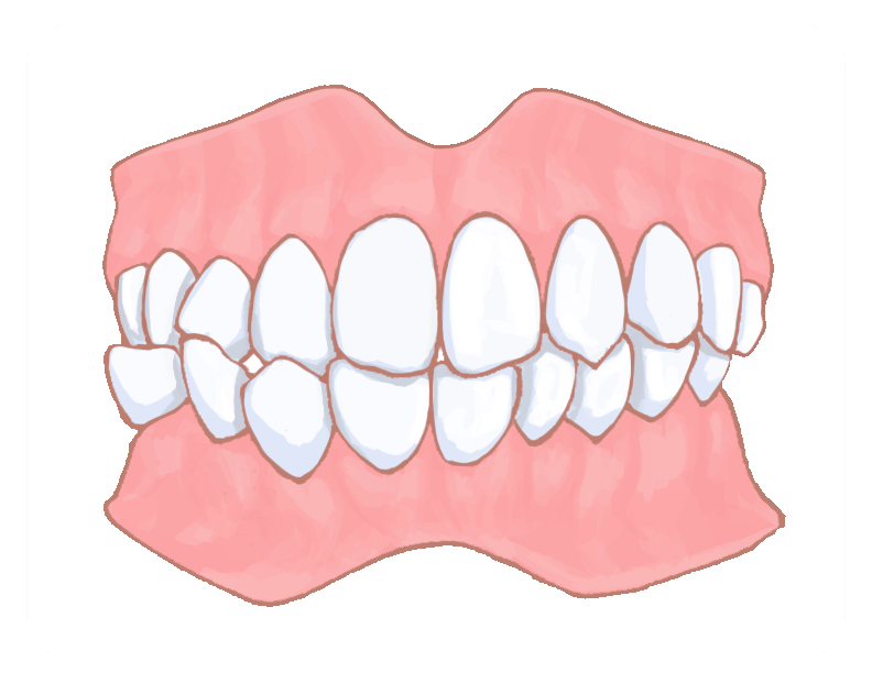 矯正歯科や歯列矯正の専門医院なら渋谷・横浜のスマイルコンセプト